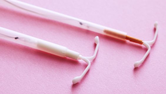 DIU de cobre e DIU hormonal
Diferença entre os dois tipos de DIU