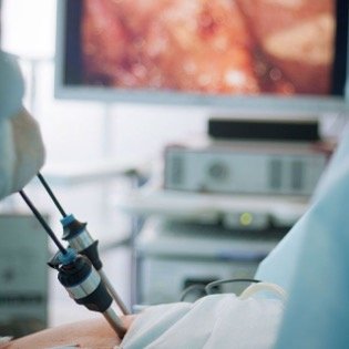 cirurgia laparoscopia
cirurgia minimamente invasiva
cirurgia lase